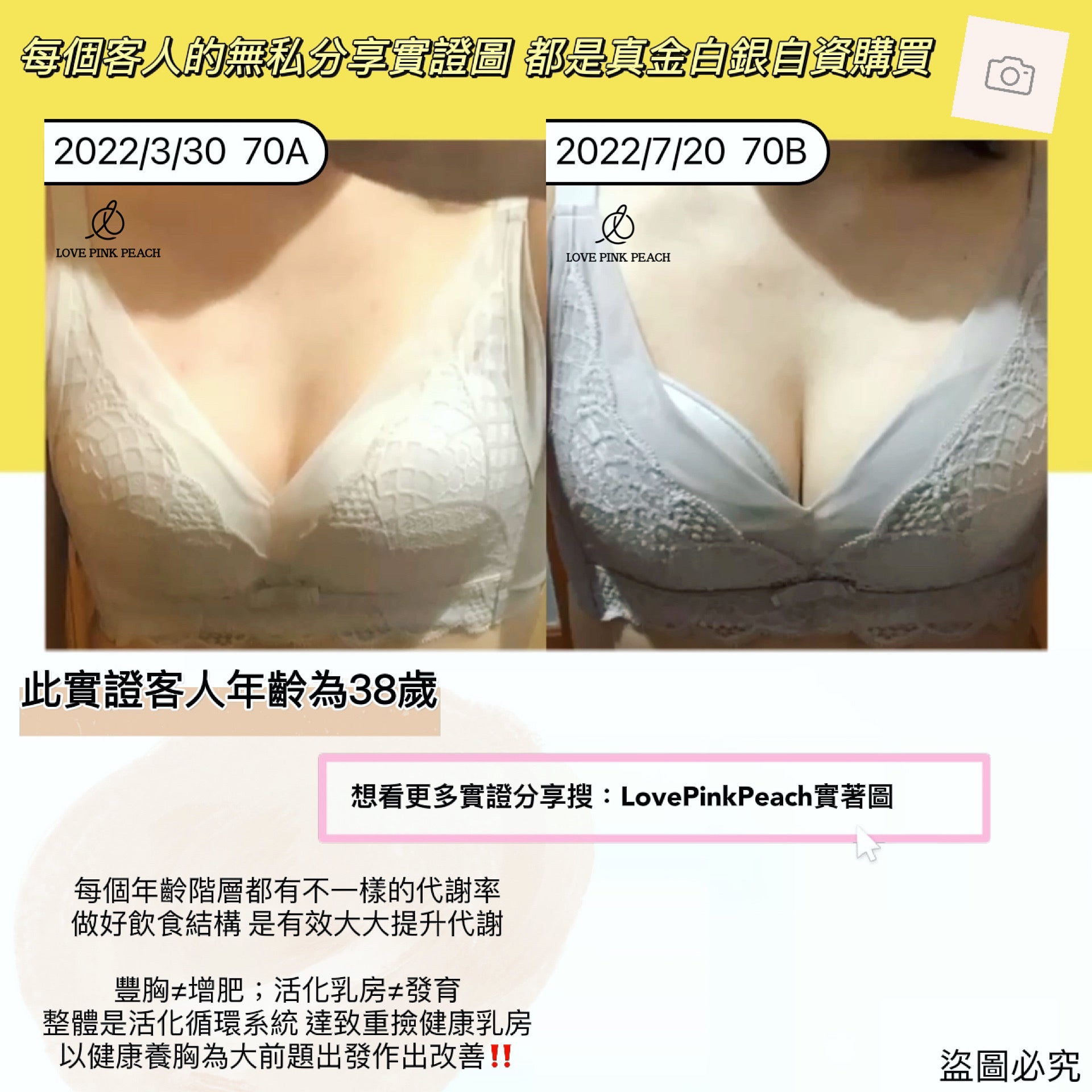 豐胸 或 矯正 需如何進行？